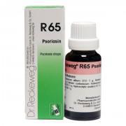Psoriasis Drops-  R-65- 22ml